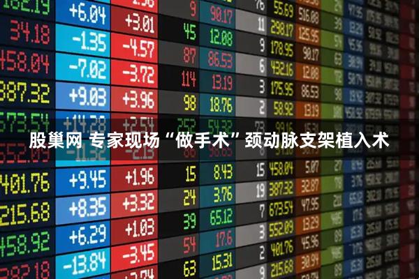 股巢网 专家现场“做手术”颈动脉支架植入术